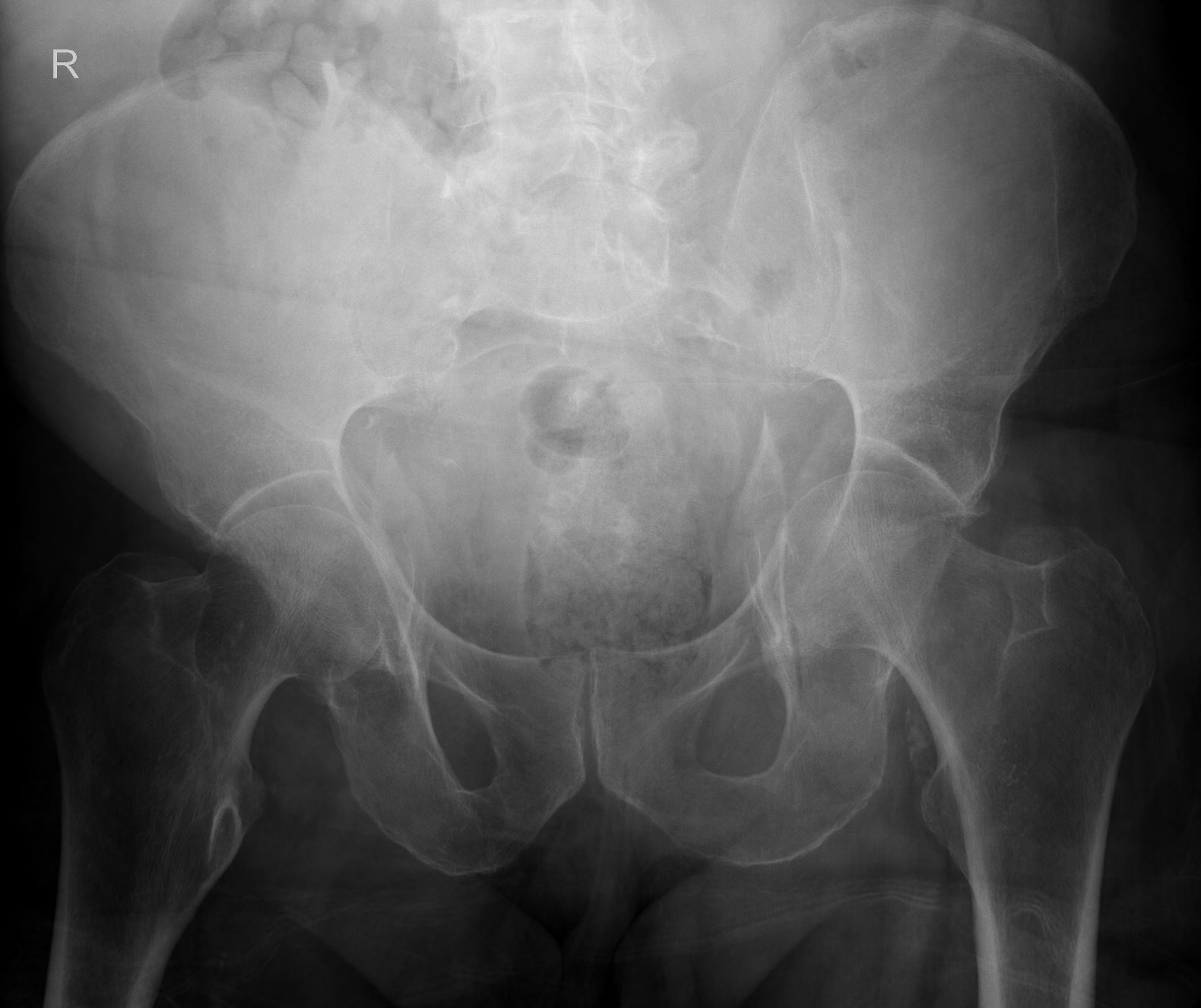 Case 18